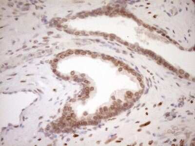 Immunohistochemistry: MED15 Antibody (OTI1C11) [NBP2-45780]