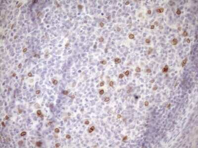 Immunohistochemistry: MED15 Antibody (OTI1C11) [NBP2-45780]