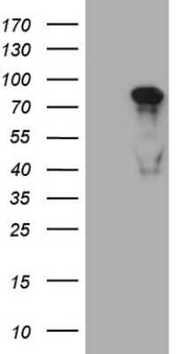 Western Blot: MED15 Antibody (OTI1C11) [NBP2-45780]