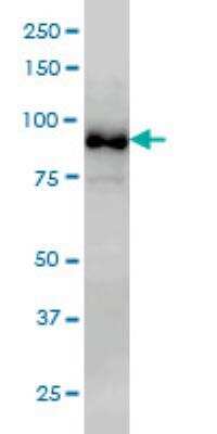Western Blot: MED15 Antibody (4A4) [H00051586-M02]