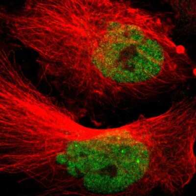 Immunocytochemistry/ Immunofluorescence: MED15 Antibody [NBP1-89018]