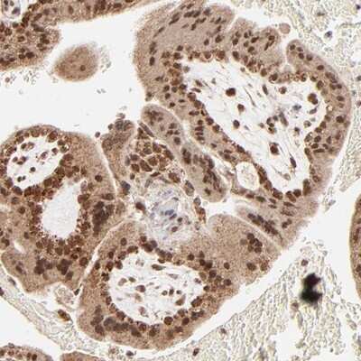 Immunohistochemistry-Paraffin: MED15 Antibody [NBP1-89018]