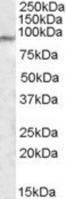 Western Blot: MED15 Antibody [NBP1-28800]