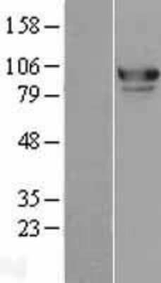 Western Blot: MED15 Overexpression Lysate [NBL1-12981]