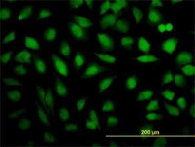 Immunocytochemistry/ Immunofluorescence: MED16 Antibody (2B7) [H00010025-M02]