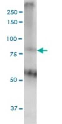 Western Blot: MED16 Antibody (2B7) [H00010025-M02]