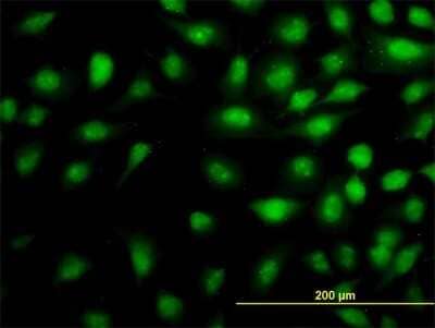 Immunocytochemistry/ Immunofluorescence: MED16 Antibody (3B10) [H00010025-M03]
