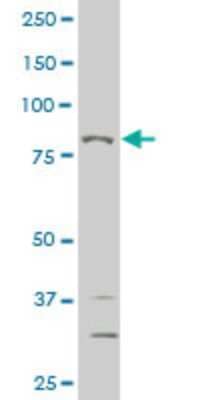 Western Blot: MED16 Antibody (3B10) [H00010025-M03]