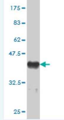 Western Blot: MED16 Antibody (3F5) [H00010025-M01]