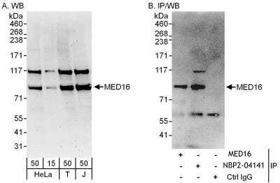 Immunoprecipitation: MED16 Antibody [NBP2-04141]