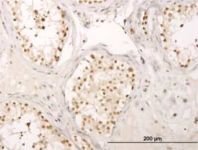 Immunohistochemistry-Paraffin: MED17 Antibody (4D4) [H00009440-M01]