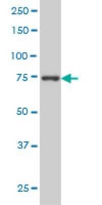 Western Blot: MED17 Antibody (4D4) [H00009440-M01]