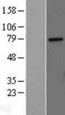 Western Blot: MED17 Overexpression Lysate [NBL1-12982]