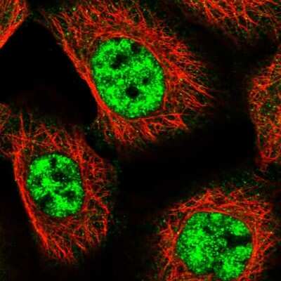 Immunocytochemistry/ Immunofluorescence: MED18 Antibody [NBP1-83673]