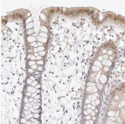Immunohistochemistry-Paraffin: MED18 Antibody [NBP1-83673]