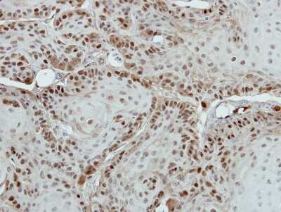 Immunohistochemistry-Paraffin: MED18 Antibody [NBP2-17257]