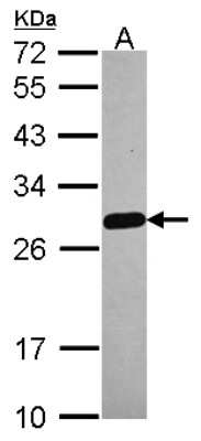 Western Blot: MED18 Antibody [NBP2-17257]