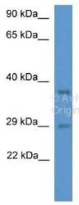 Western Blot: MED19 Antibody [NBP1-79597]