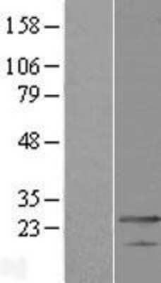 Western Blot: MED19 Overexpression Lysate [NBL1-12984]