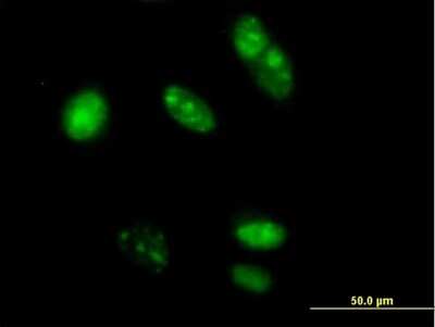 Immunocytochemistry/ Immunofluorescence: MED20 Antibody [H00009477-B01P]