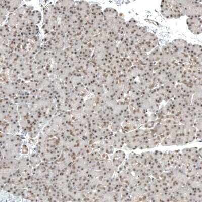 Immunohistochemistry-Paraffin: MED20 Antibody [NBP1-84140]