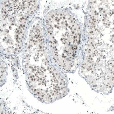 Immunohistochemistry-Paraffin: MED20 Antibody [NBP1-84140]