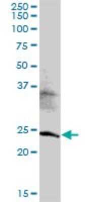 Western Blot: MED20 Antibody [H00009477-B01P]