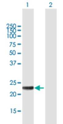 Western Blot: MED20 Antibody [H00009477-B01P]