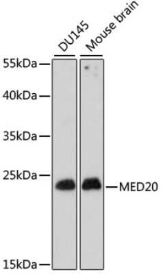 Western Blot: MED20 AntibodyAzide and BSA Free [NBP3-04528]