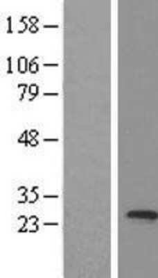 Western Blot: MED20 Overexpression Lysate [NBL1-12985]