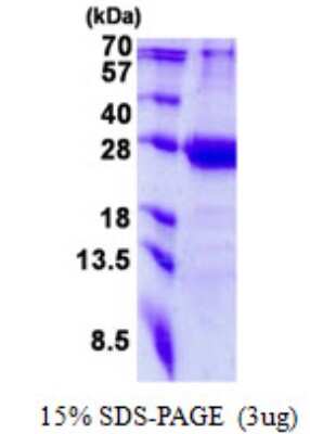 SDS-PAGE: Recombinant Human MED20 His Protein [NBP2-23220]