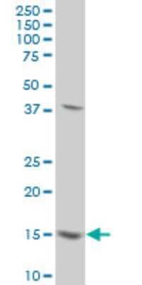 Western Blot: MED21 Antibody (2D9) [H00009412-M10]