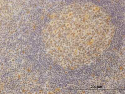 Immunohistochemistry-Paraffin: MED21 Antibody (3E9) [H00009412-M08]