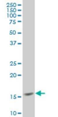 Western Blot: MED21 Antibody (3E9) [H00009412-M08]