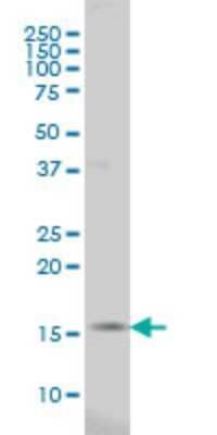 Western Blot: MED21 Antibody (5A6) [H00009412-M04]