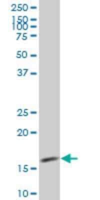 Western Blot: MED21 Antibody (6B6) [H00009412-M03]