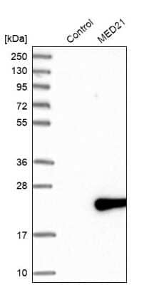 Western Blot: MED21 Antibody [NBP1-87006]