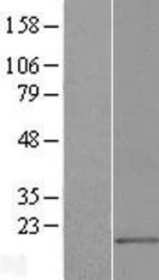 Western Blot: MED21 Overexpression Lysate [NBL1-12986]