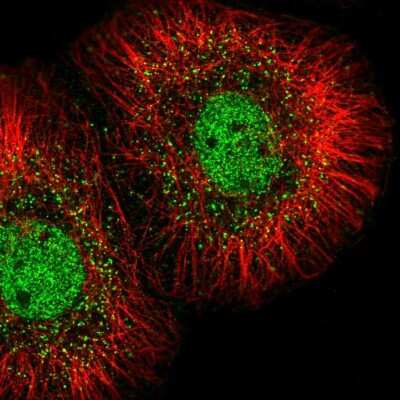 Immunocytochemistry/ Immunofluorescence: MED23 Antibody [NBP2-56372]