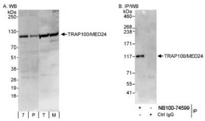 Western Blot: MED24 Antibody [NB100-74599]