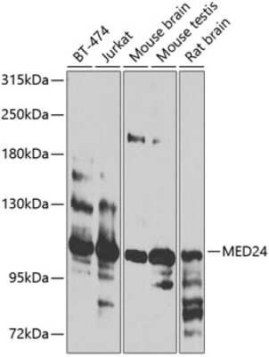 Western Blot: MED24 AntibodyBSA Free [NBP3-04464]