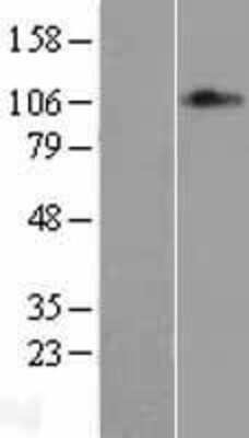 Western Blot: MED24 Overexpression Lysate [NBL1-12988]