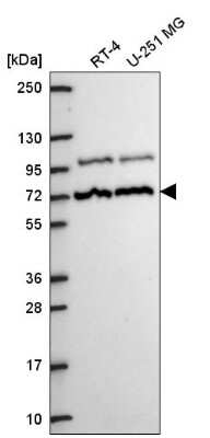 Western Blot: MED25 Antibody [NBP2-55868]