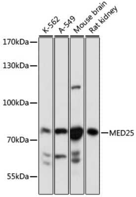 Western Blot: MED25 AntibodyAzide and BSA Free [NBP3-04944]