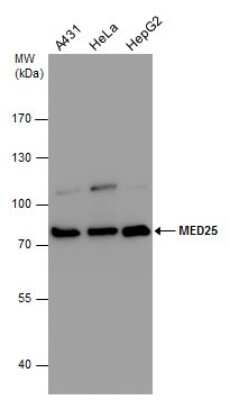 Western Blot: MED25 Antibody [NBP3-12909]