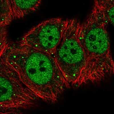 Immunocytochemistry/ Immunofluorescence: MED26 Antibody [NBP2-57785]