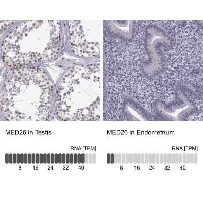 Immunohistochemistry-Paraffin: MED26 Antibody [NBP2-62629]