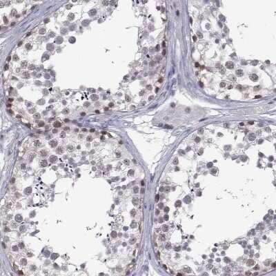 Immunohistochemistry-Paraffin: MED26 Antibody [NBP2-62629]