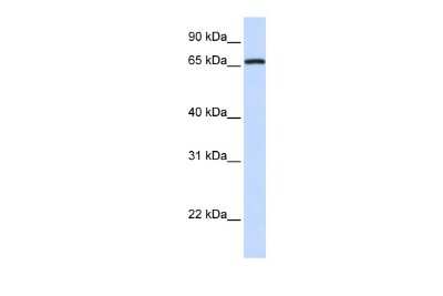 Western Blot: MED26 Antibody [NBP3-10308]