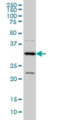 Western Blot: MED27 Antibody (8B8) [H00009442-M01]